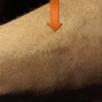 limitless aftercare - my arm showing scar